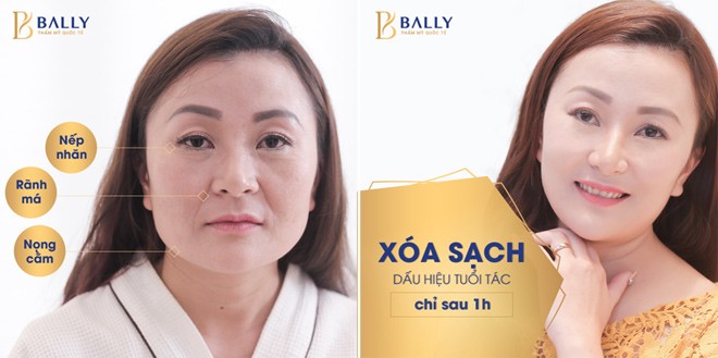 nhan qua nua ti khi tham gia le chuyen giao cong nghe tre hoa 2018 tai bally - 2